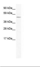 Polyclonal Rabbit anti‑Mouse LASS4 Antibody (aa49‑98, WB) LS‑C30939