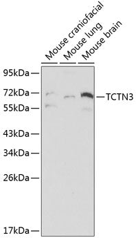 TCTN3 Rabbit pAb