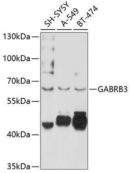 GABRB3 Rabbit pAb
