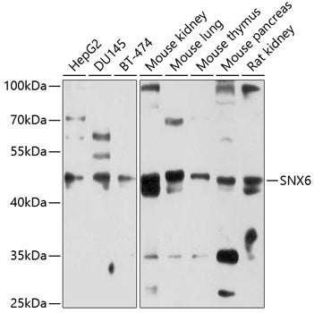 SNX6 Rabbit pAb