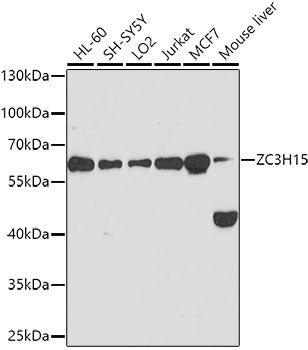 ZC3H15 Rabbit pAb