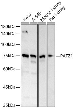 PATZ1 Rabbit pAb