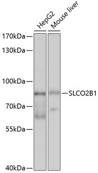SLCO2B1 Rabbit pAb