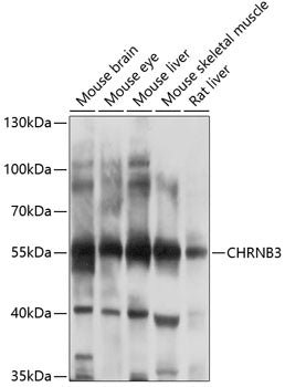 CHRNB3 Rabbit pAb