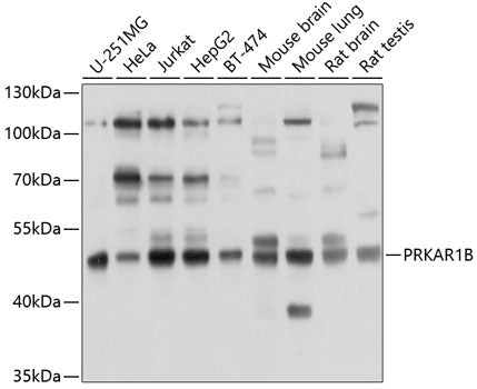 PRKAR1B Rabbit pAb