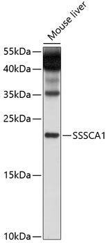 SSSCA1 Rabbit pAb