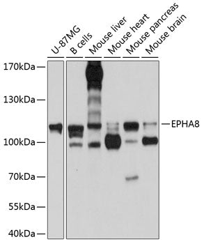 EPHA8 Rabbit pAb