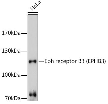 Eph receptor B3 (EPHB3) Rabbit pAb