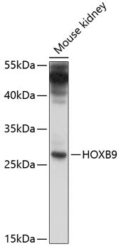 HOXB9 Rabbit pAb