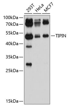 TIPIN Rabbit pAb