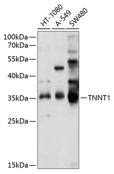 TNNT1 Rabbit pAb