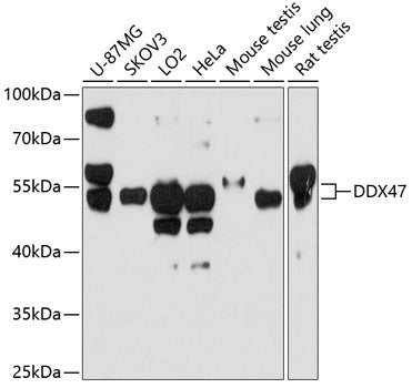 DDX47 Rabbit pAb
