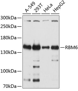 RBM6 Rabbit pAb