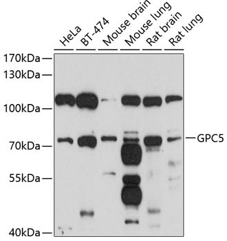 GPC5 Rabbit pAb