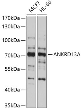 ANKRD13A Rabbit pAb