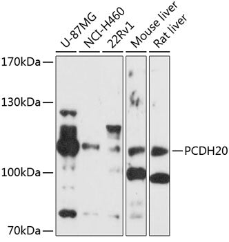 PCDH20 Rabbit pAb
