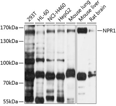 NPR1 Rabbit pAb