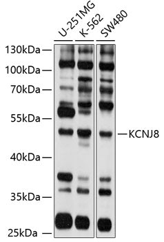 KCNJ8 Rabbit pAb