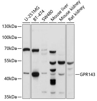 GPR143 Rabbit pAb