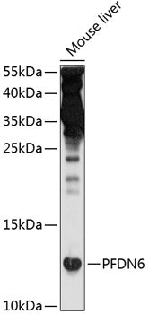 PFDN6 Rabbit pAb
