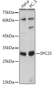 SPC25 Rabbit pAb