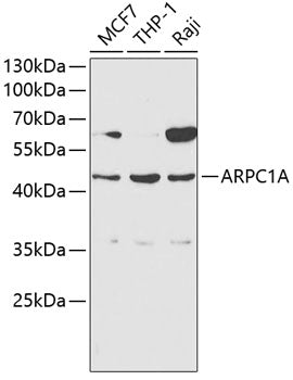 ARPC1A Rabbit pAb