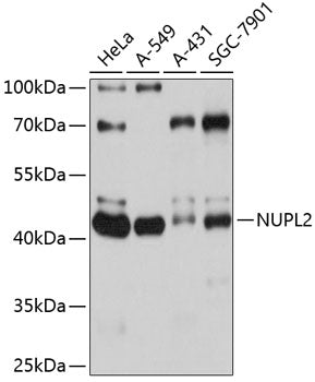 NUPL2 Rabbit pAb