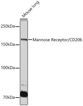 Mannose Receptor/CD206 Rabbit mAb