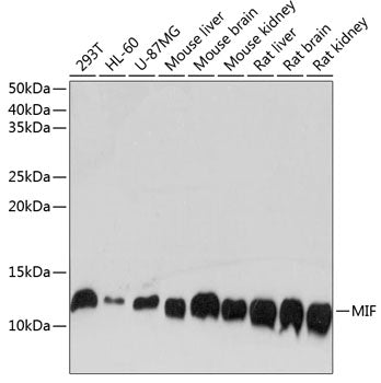 MIF Rabbit mAb