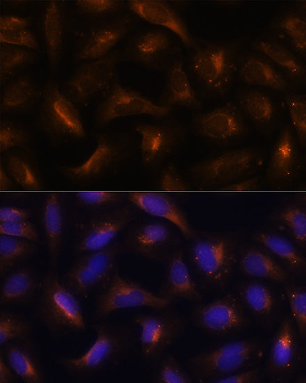 SQSTM1/p62 Rabbit pAb