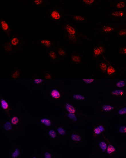 BRCA1 Rabbit pAb