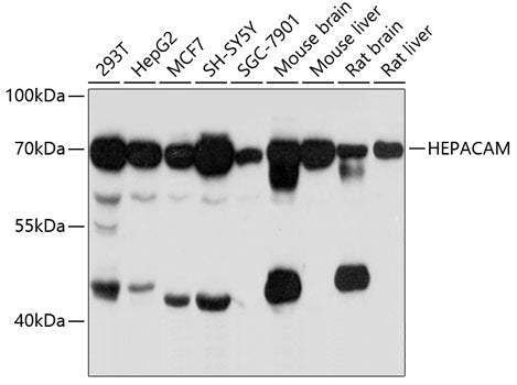 HEPACAM Rabbit pAb