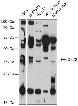 CDK20 Rabbit pAb