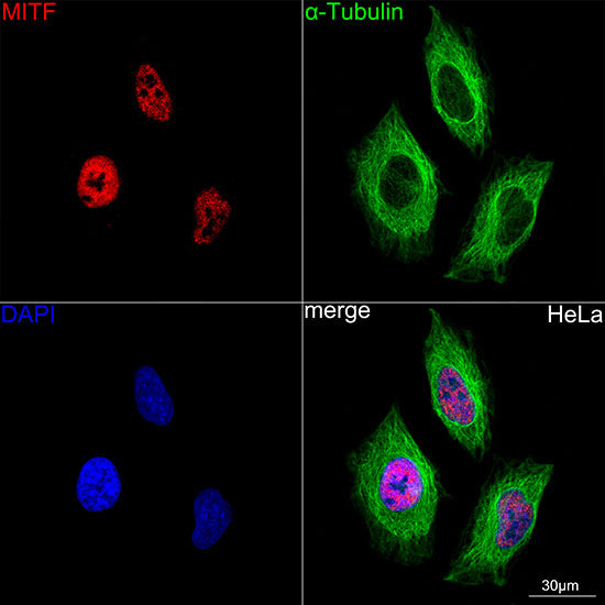 MITF Rabbit mAb