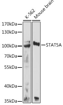 STAT5A Rabbit pAb