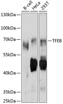 TFEB Rabbit pAb