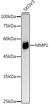 MMP1 Rabbit pAb