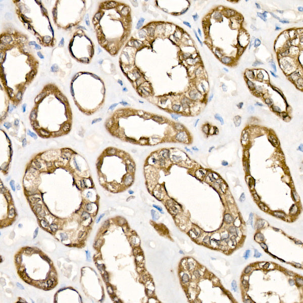TNFR2/TNFRSF1B Rabbit mAb