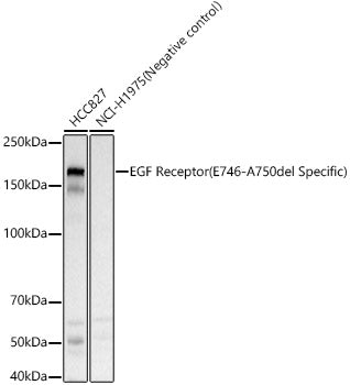 EGF Receptor (E746-A750del Specific) Rabbit pAb