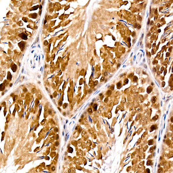 PARG Rabbit mAb