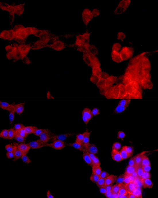 uPAR/U-PAR Rabbit mAb