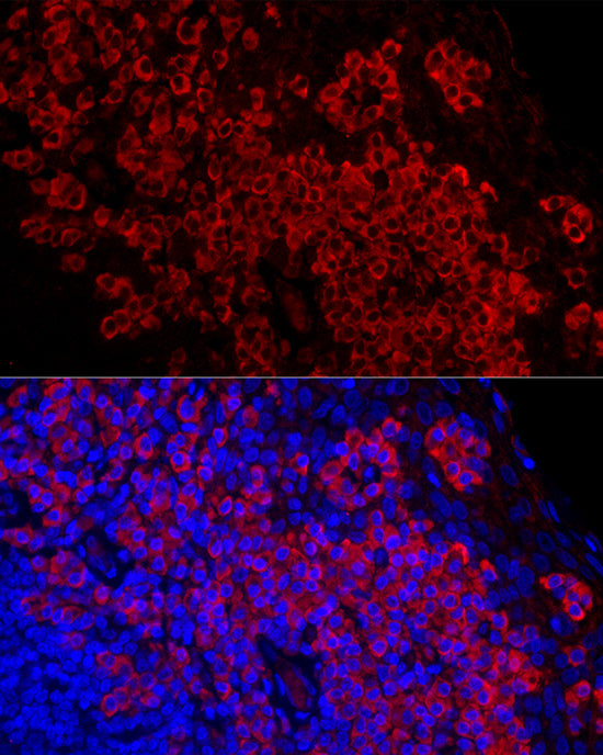 DARC Rabbit mAb