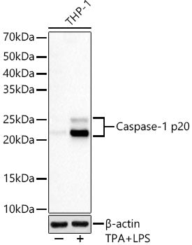 Caspase-1 p20 Rabbit mAb
