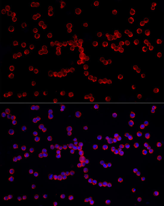 IL4 Rabbit mAb