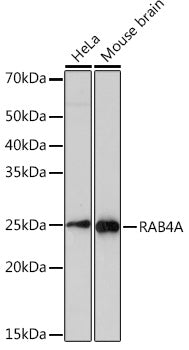 RAB4A Rabbit mAb