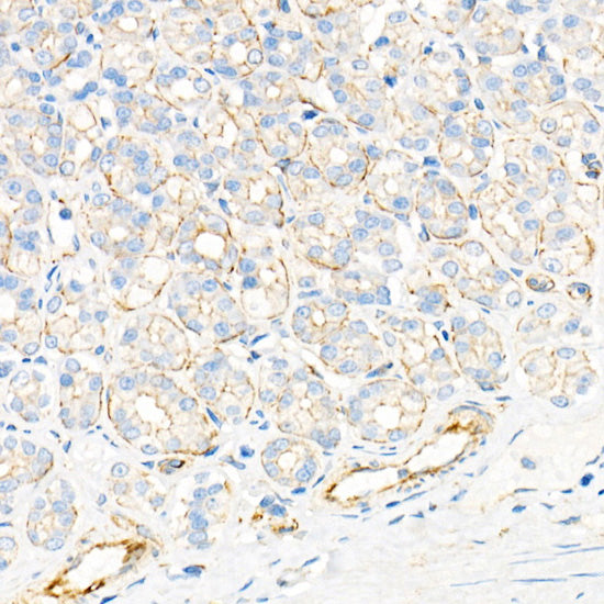 Plectin Rabbit mAb
