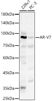 AR-V7 Rabbit pAb