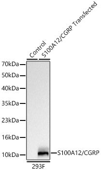 S100A12/CGRP Rabbit mAb