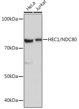 HEC1/NDC80 Rabbit mAb