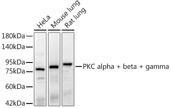 PKC alpha + beta + gamma Rabbit mAb